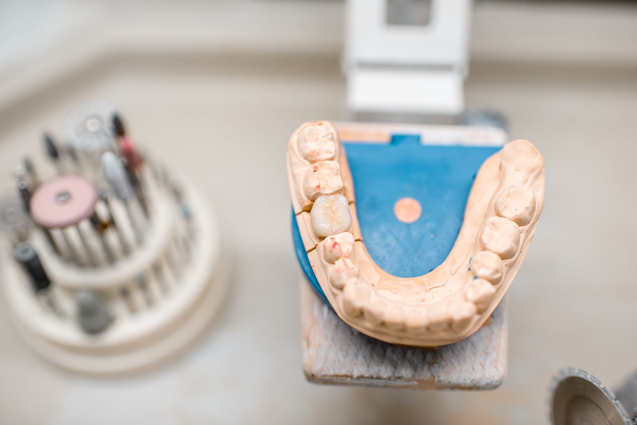 Partial Implant Dentures