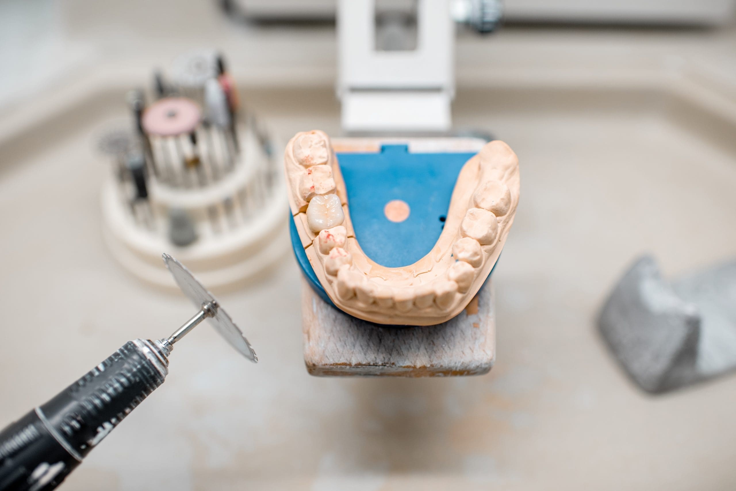 dental prosthesis